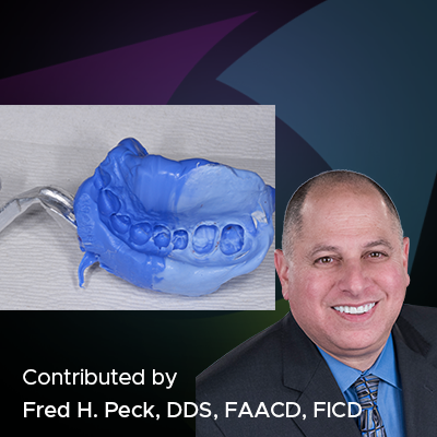 a blog featured image with the photo of doctor Fred Peck and the impression tray with the impression material in it
