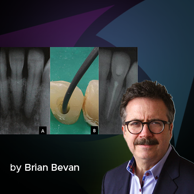 the use of bioceramic materials in endodontics - a blog post banner