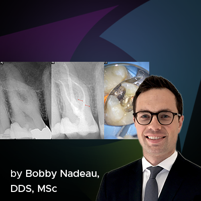 a blog post banner about dentin conservation during root canal treatment by dr. Bobby Nadeau, DDS, MSc