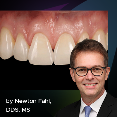 a blog banner for the article by Dr. Newton Fahl on the restoring worn dentition featuring the after image