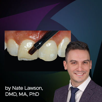 Ask the Expert: An Interview with Nate Lawson, DMD, MA, PhD on Composite Polishers