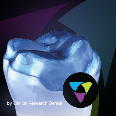 Occlusal Onlays? Simple!