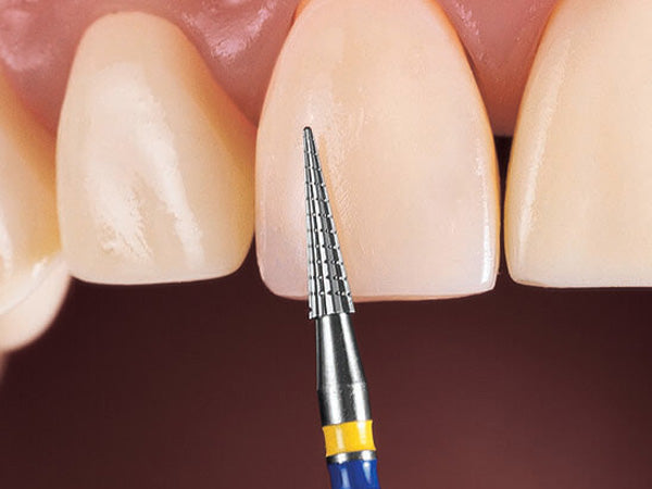 Load image into Gallery viewer, FS6Q tungsten carbide on a facial surface during composite finishing