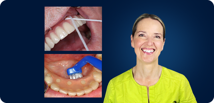 preventing peri-implant disease with Dr. Michaela von Geijer