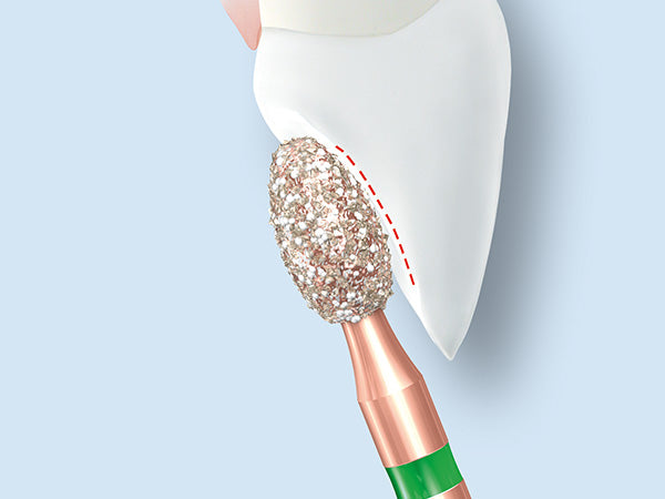 Load image into Gallery viewer, Nail art tool with glittery head and green handle on a light blue background