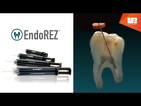 Load and play video in Gallery viewer, how to use EndoRez root canal sealer