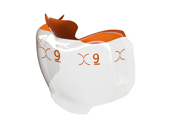 Load image into Gallery viewer, Bioclear Evolve Posterior Matrix Refills Orange 9mm