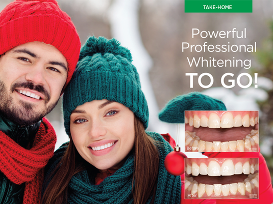 Ultradent™ Opalescence™ Whitening Marketing Literature for Dental Practices