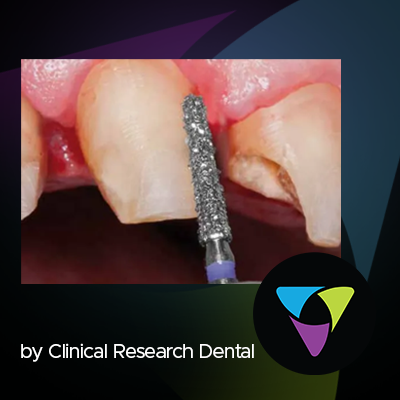 A Premium Brand of Burs You Can Afford