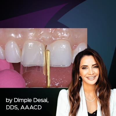 Patient Management and Treatment of the Midline Diastema