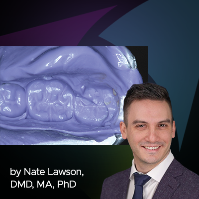 Ask the Expert: An Interview with Nate Lawson, DMD, MA, PhD on the Fabrication of Temporary Restorations