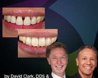 Patient smiling with Dr Clark and Dr Regalado on the corners