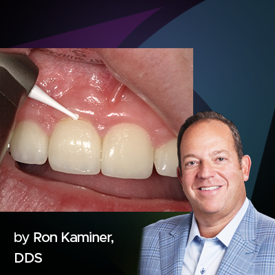 Minimally Invasive, Maximum Performance: A Common Sense Approach to Veneer Repair