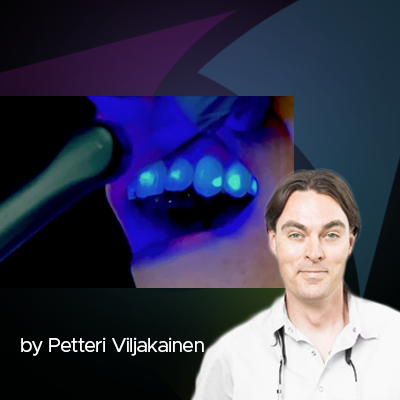 A Curing Light is not just a Light: Flexibility is Crucial