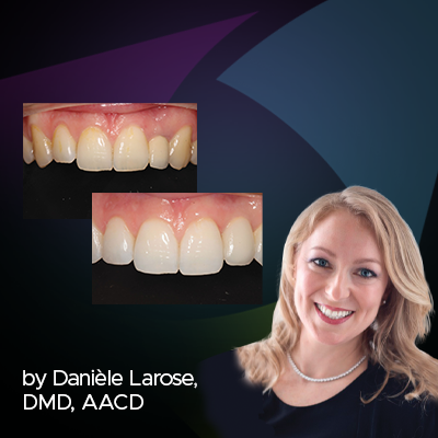 The Missing Tooth – Clinical Research Dental