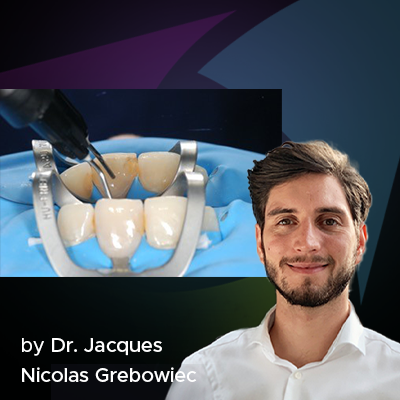 The Walking Bleach Method – Clinical Research Dental