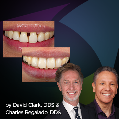 Patient smiling with Dr Clark and Dr Regalado on the corners