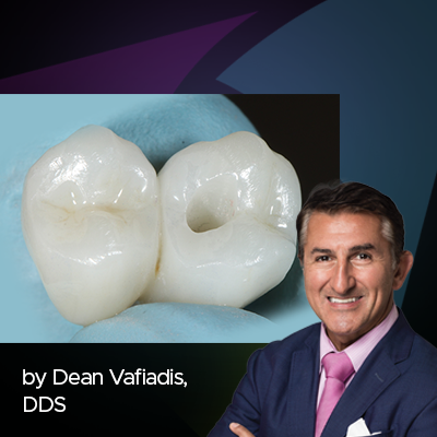 Ask the Expert: An Interview with Dean Vafiadis, DDS on Adjusting and Polishing Zirconia Restorations