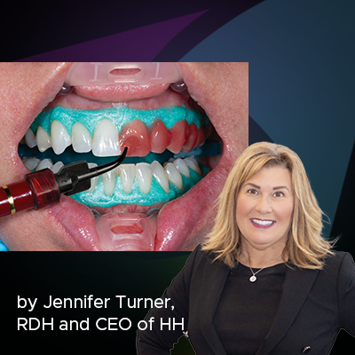 The Business of Whitening: Simple to Implement, Impossible to Ignore