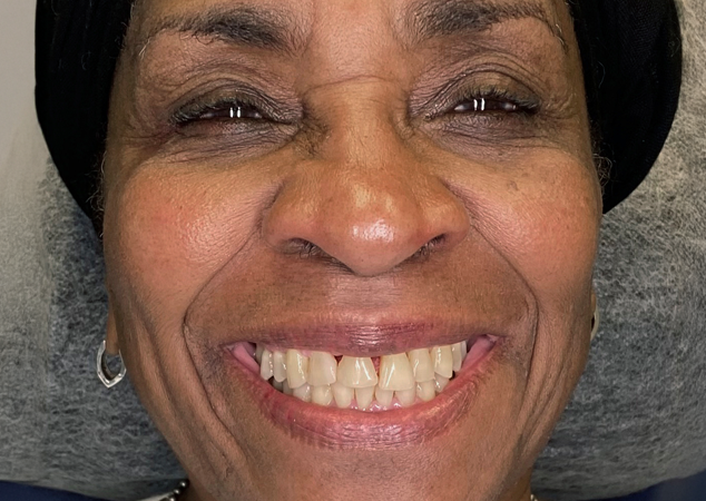 Patient's smile before procedure