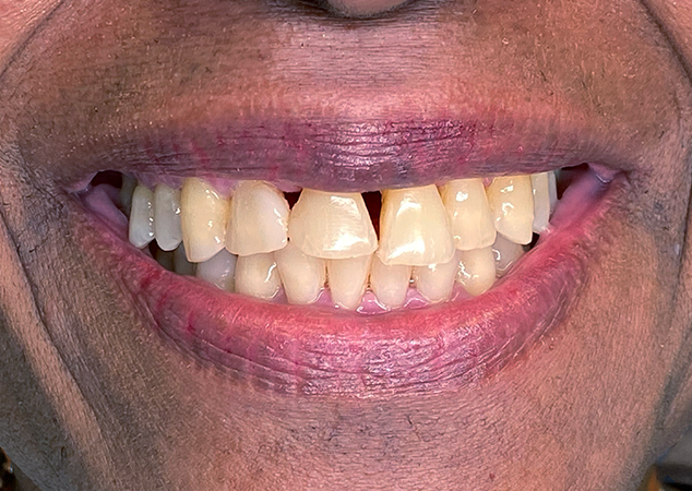 Patient's smile in detail