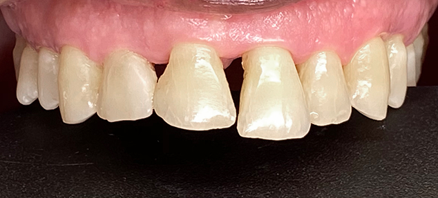 patient's smile isolated showing imperfections in detail
