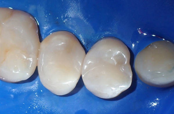 Final restoration result