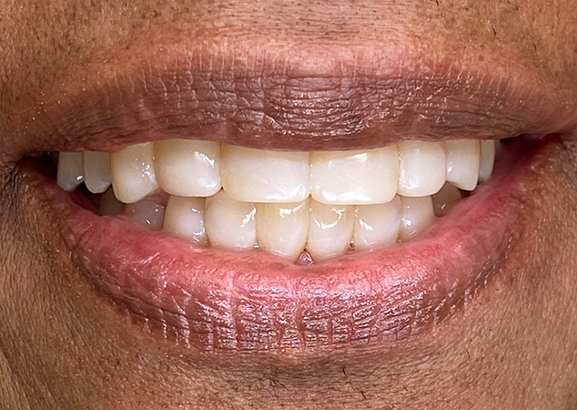 Final restoration result