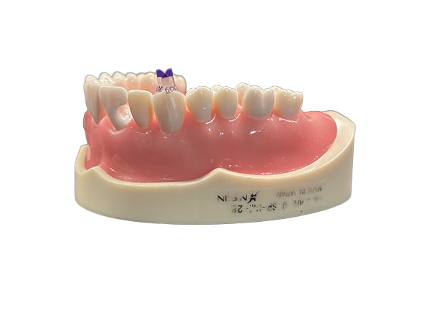 Load image into Gallery viewer, Bioclear™ Tooth &amp; Surface Specific (TSS) Anterior Matrix Refills

