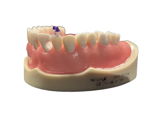 Bioclear™ Tooth & Surface Specific (TSS) Anterior Matrix Refills