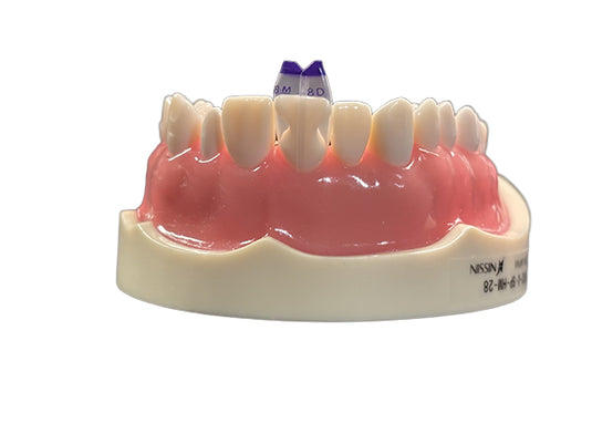 Bioclear™ Tooth & Surface Specific (TSS) Anterior Matrix Refills