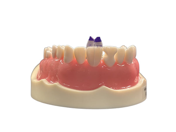 Load image into Gallery viewer, Bioclear™ Tooth &amp; Surface Specific (TSS) Anterior Matrix Refills
