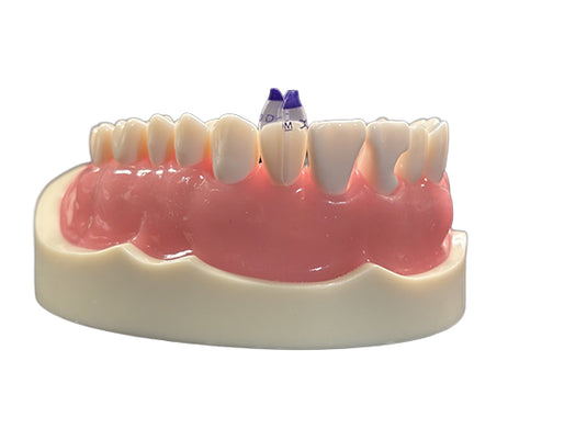 Bioclear™ Tooth & Surface Specific (TSS) Anterior Matrix Refills