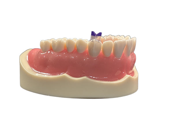 Load image into Gallery viewer, Bioclear™ Tooth &amp; Surface Specific (TSS) Anterior Matrix Refills
