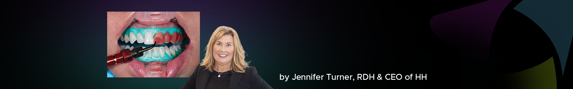 Blog banner featuring Jennifer Turner and a clinical image