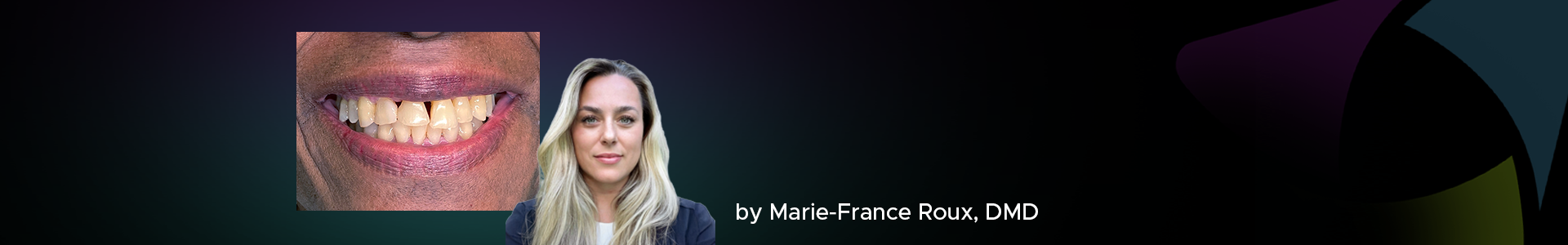 Blog banner featuring Dr. Marie-France Roux and a clinical case
