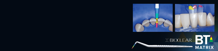 bicolear bt matrix promotion banner