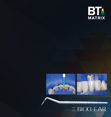 bicolear bt matrix promotion banner