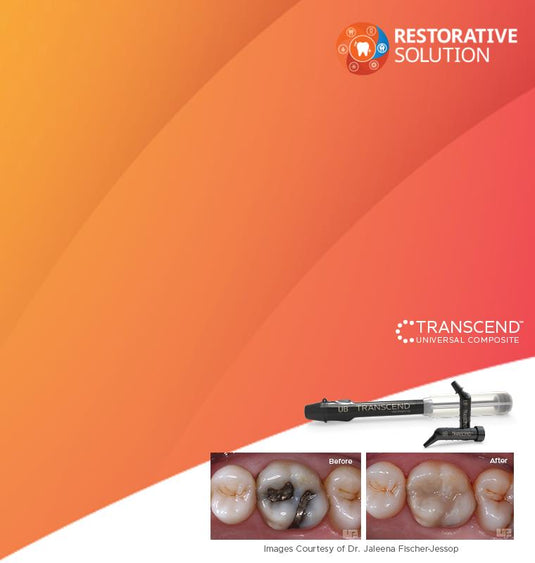 Simply Beautiful Results for Any Restoration!