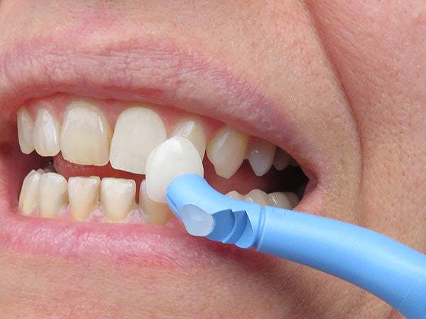 Load image into Gallery viewer, AdDent Vac-Tak™ Veneer Placement Instrument
