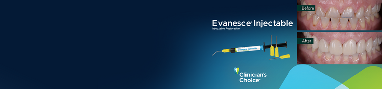 Evanesce Injectable composite resin before and after anterior tooth restoration by Clinician's Choice.