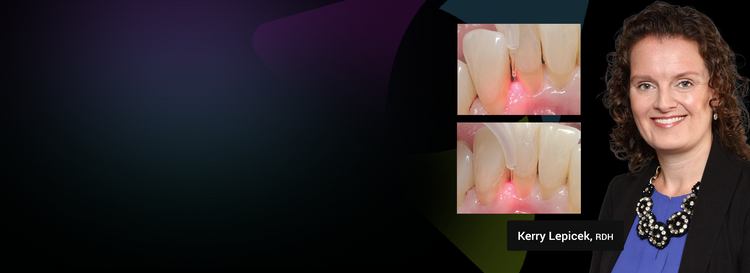 integrating laser technology into your preventive care strategies by kerry