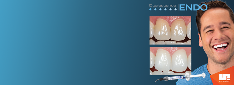 LIFE-CHANGING, MINIMALLY INVASIVE WHITENING