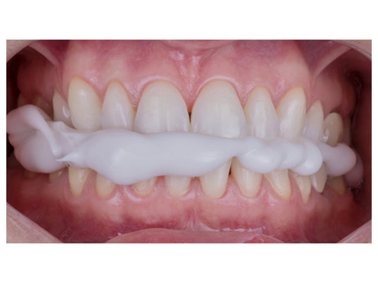 vanilla bite bitten front